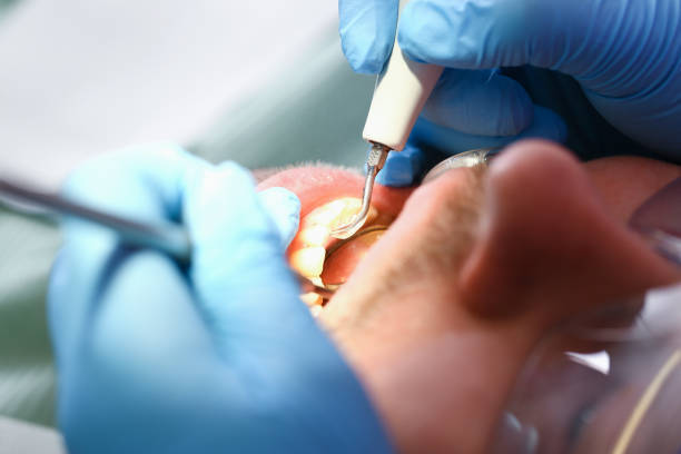 Best Urgent Dental Care for Toothache in Perry, MI