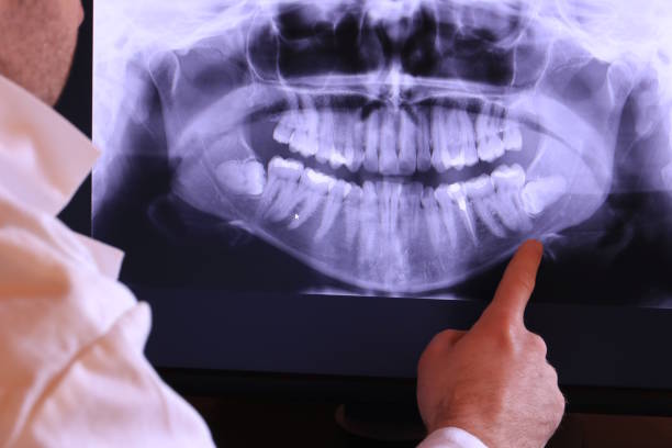 Best Emergency Dentist for Knocked-Out Tooth in Perry, MI