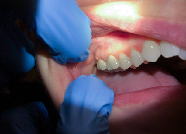 Best Mobile Emergency Dentist in Perry, MI
